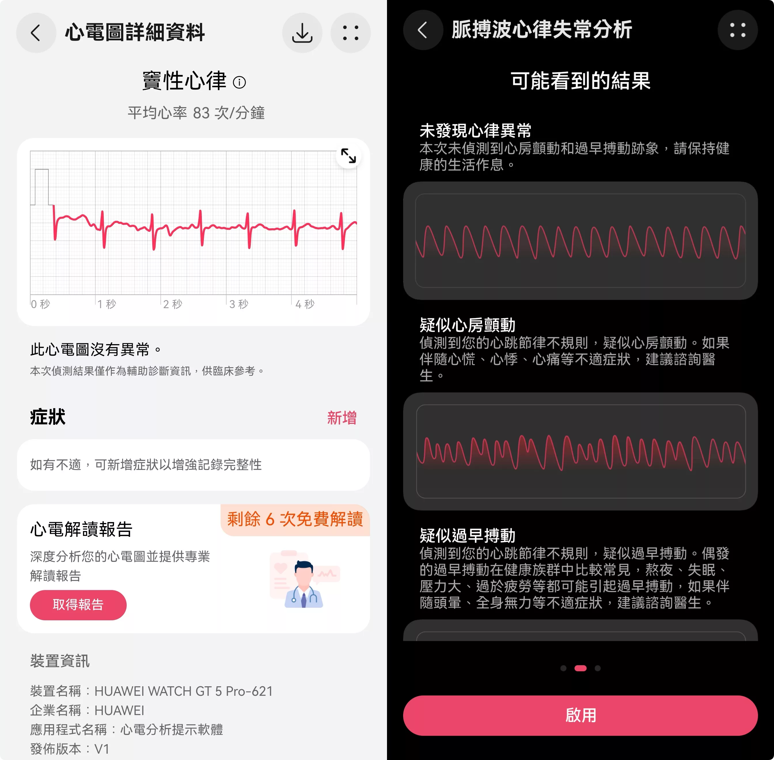 華為 WATCH GT 5 Pro 上手:「情緒健康」功能很神奇,滑臉書真的會導致心情變壞 WATCH GT 5 Pro 上手 AI 應用案例, AI, Android, 實用工具, 小工具, 小米, 教學